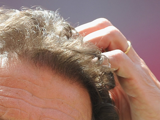 'Super lice' found in 48 states, study says